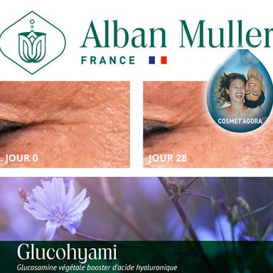 Le Glucohyami d'Alban Muller