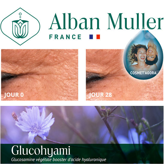 Le Glucohyami d'Alban Muller