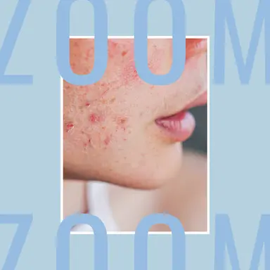 Les nouveaux soins visage pour les peaux sensibles