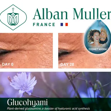 Le Glucohyami d'Alban Muller