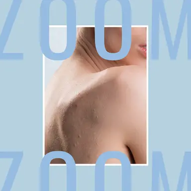 Les soins anti-imperfections pour le corps