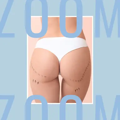Les soins spécial fesses