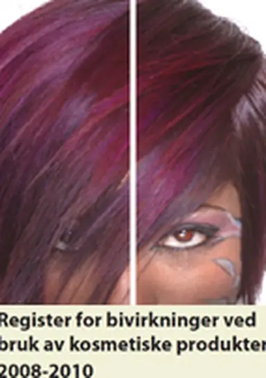 ©Nasjonalt folkehelseinstitutt/Norwegian Institute of Public Health